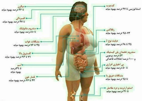 رژیم لاغری
