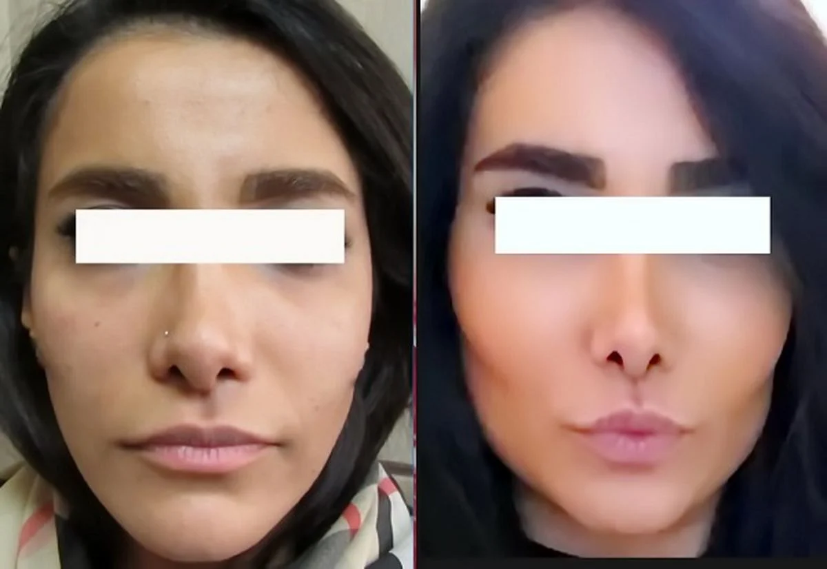 لاغری