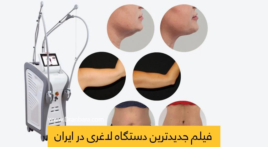لاغری