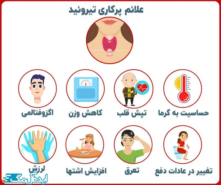 تیروئید