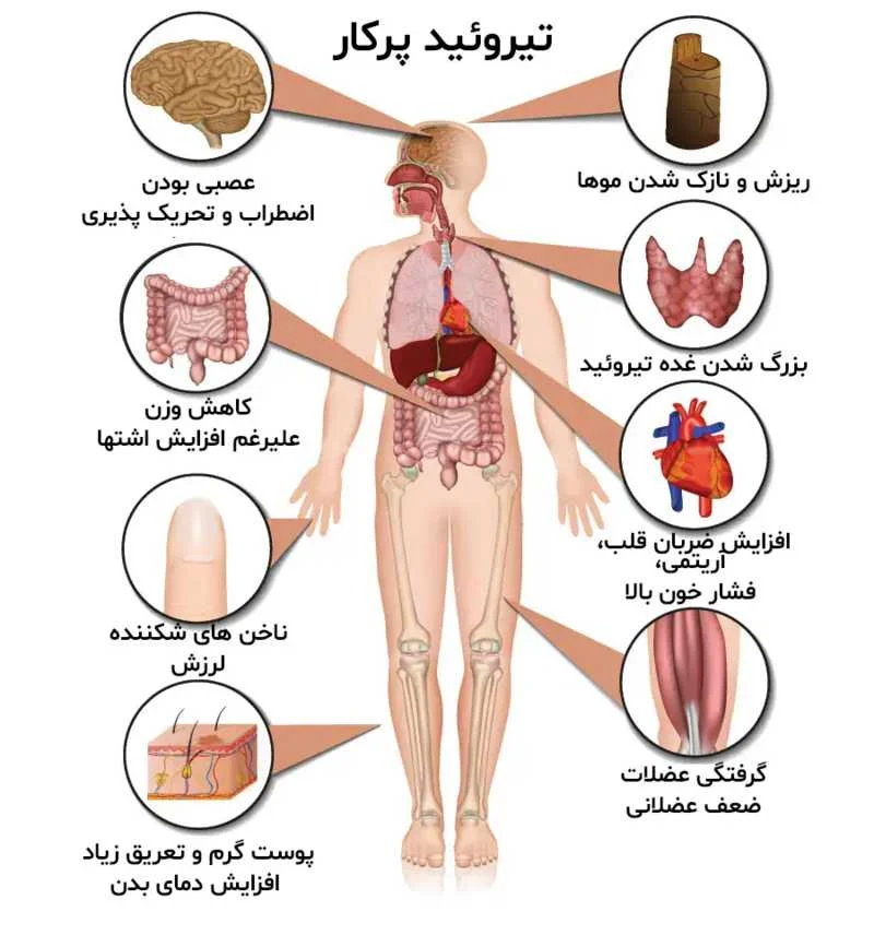 تیروئید