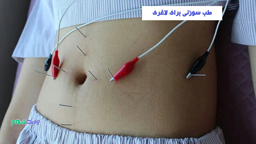 لاغری