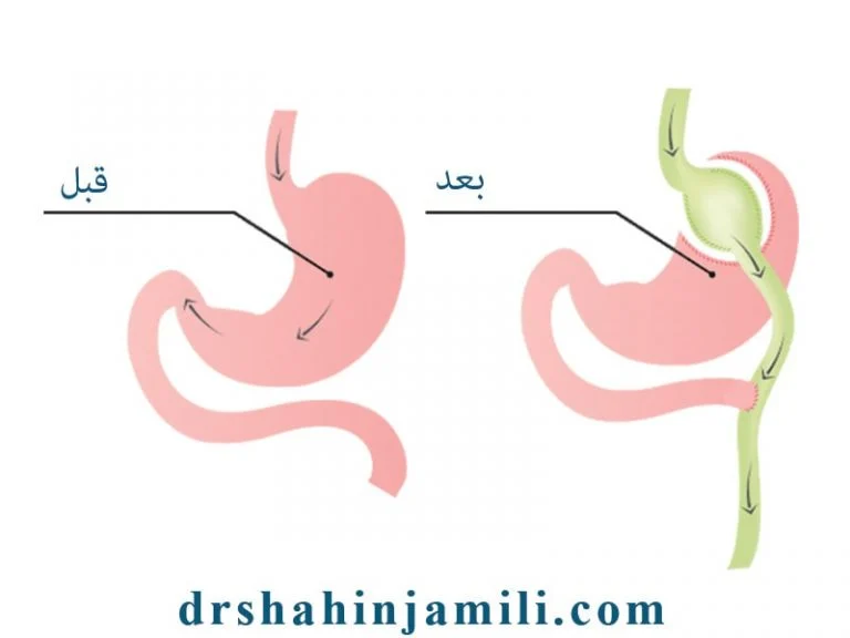 رژیم غذایی