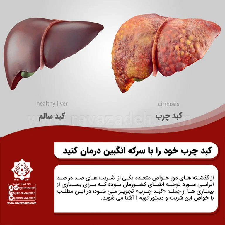رژیم غذایی رژیم غذایی