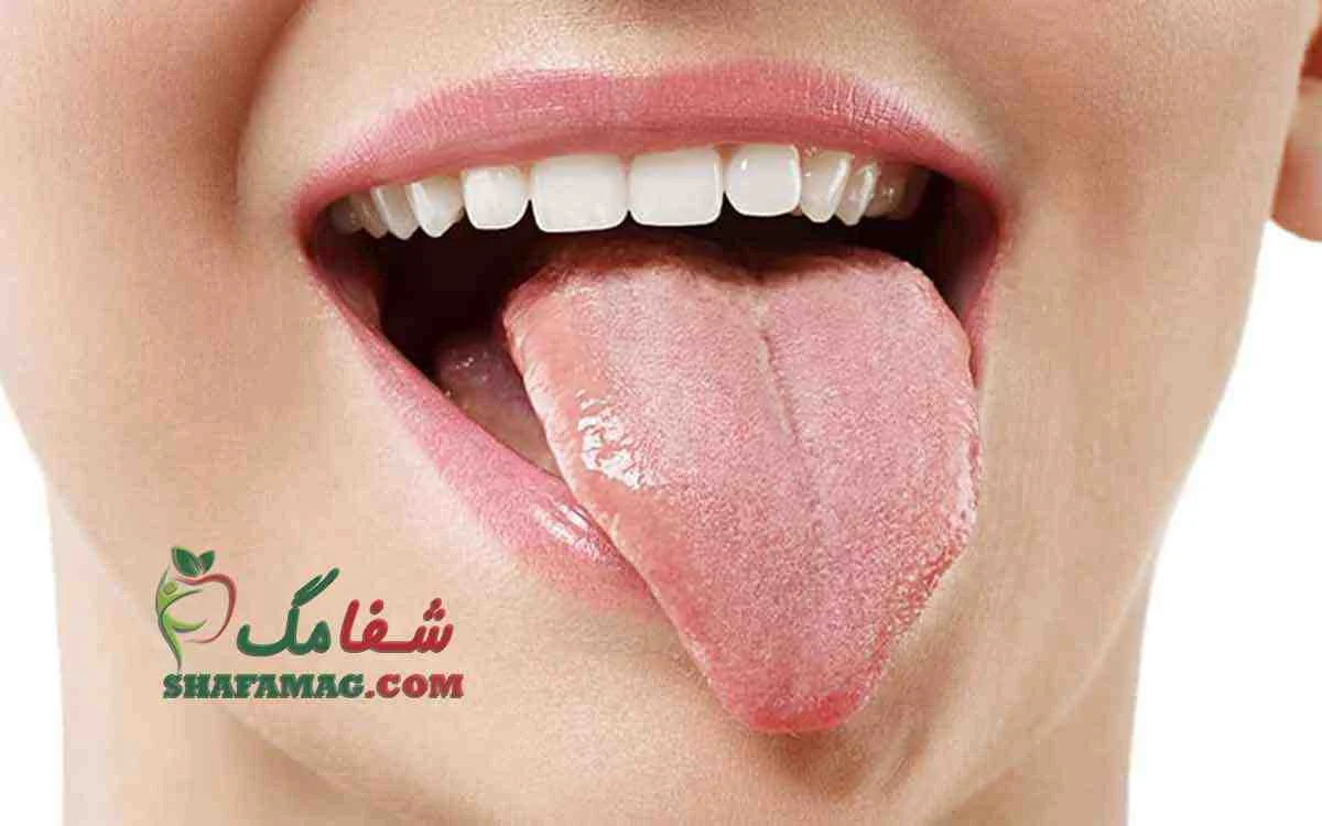رژیم غذایی رژیم غذایی