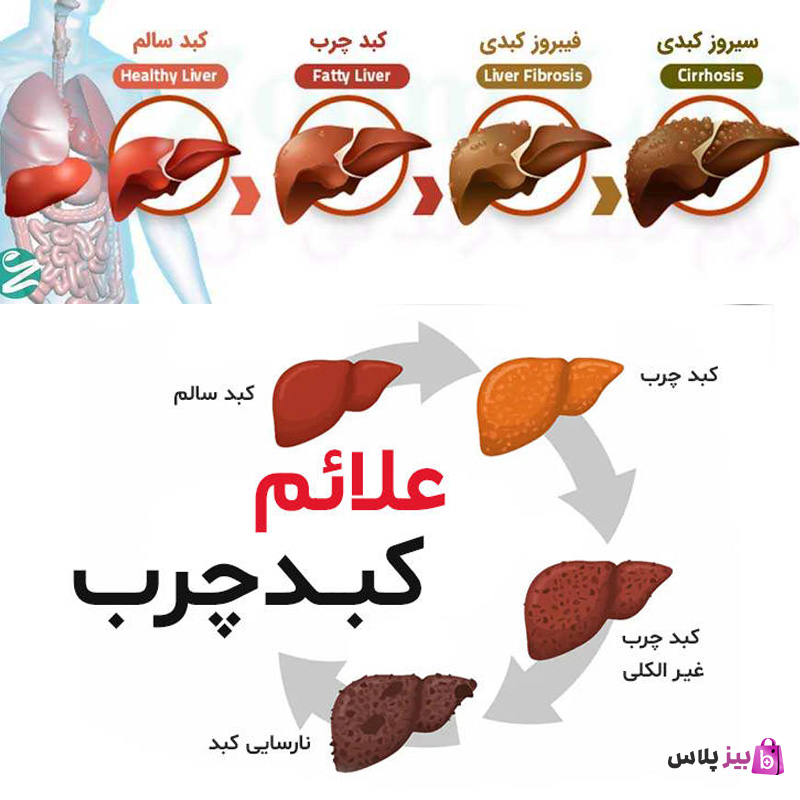 رژیم غذایی