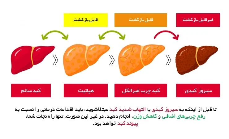 رژیم غذایی