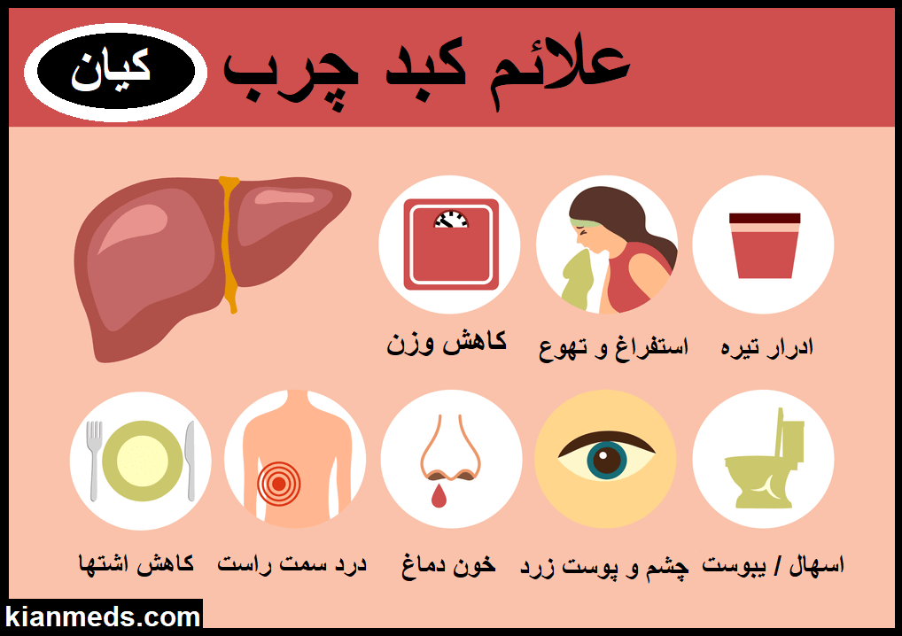 رژیم غذایی