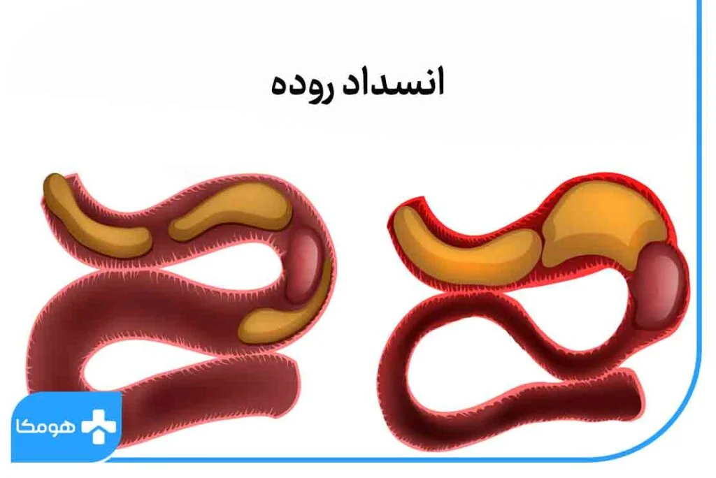 رژیم غذایی