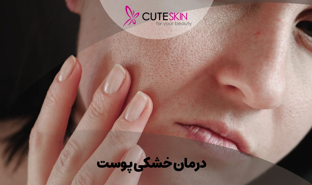پوست | رژیم غذایی پوست