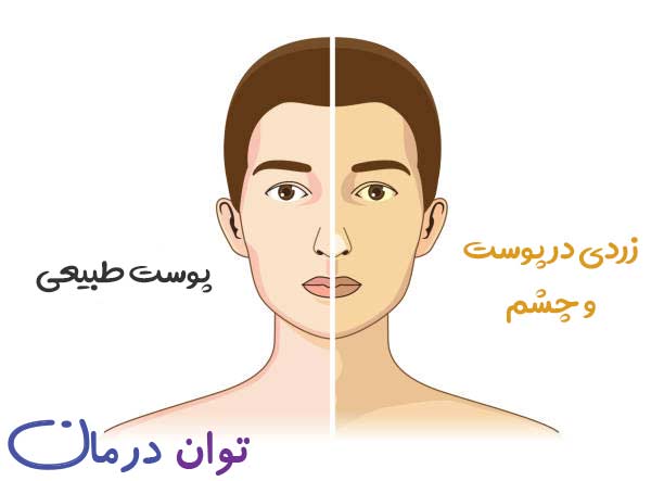 رژیم غذایی