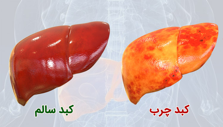 رژیم غذایی