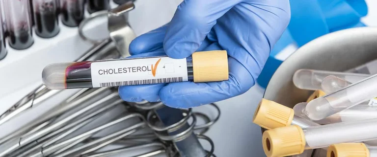 Cholesterol چیست
