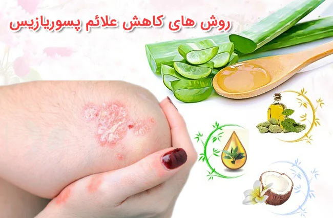 رژیم غذایی