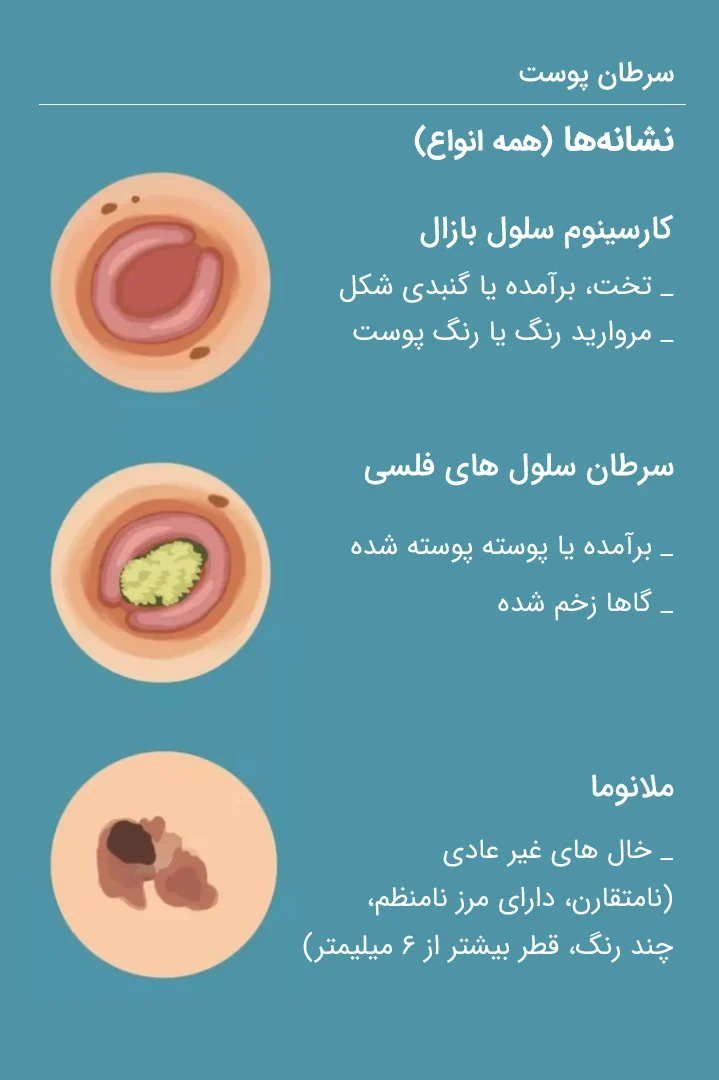 پوست