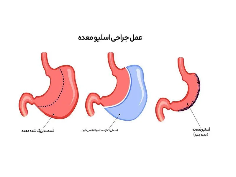رژیم غذایی