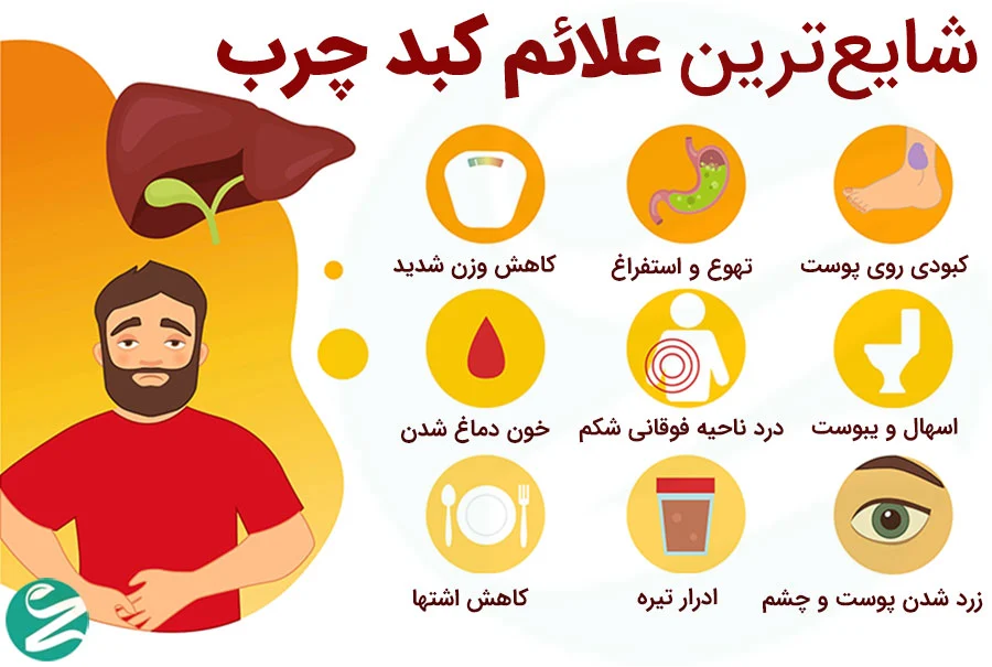 رژیم غذایی رژیم غذایی