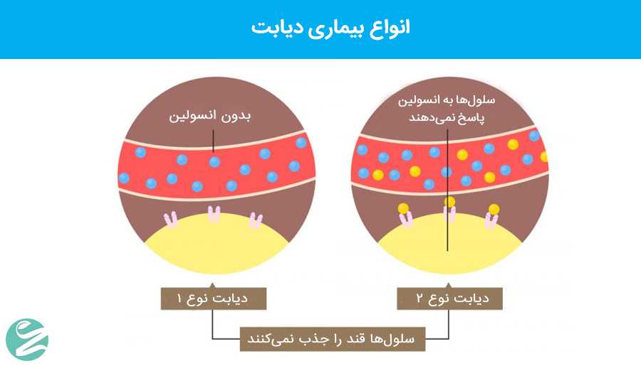 رژیم غذایی