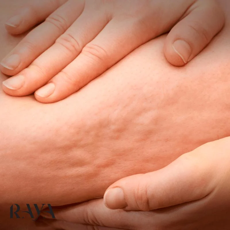 رژیم غذایی رژیم غذایی