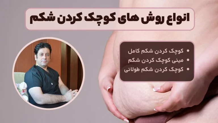 کوچک کردن شکم