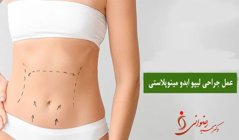 عمل لیپو ابدو