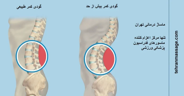 گودی کمر