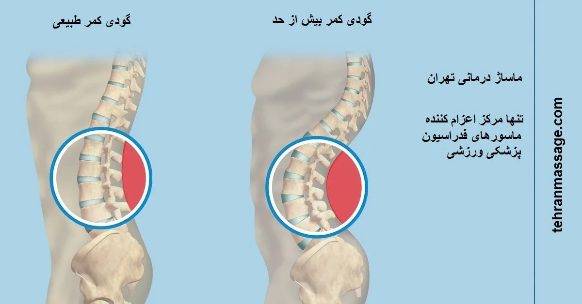 رژیم غذایی