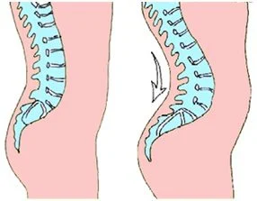 رژیم غذایی