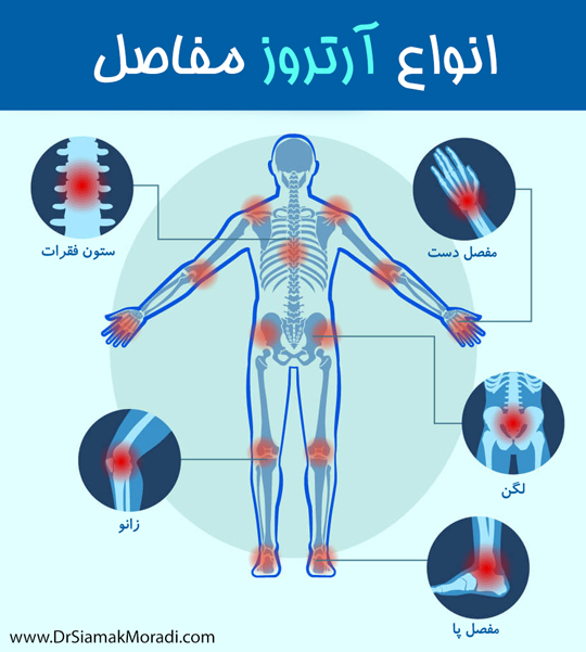 رژیم غذایی