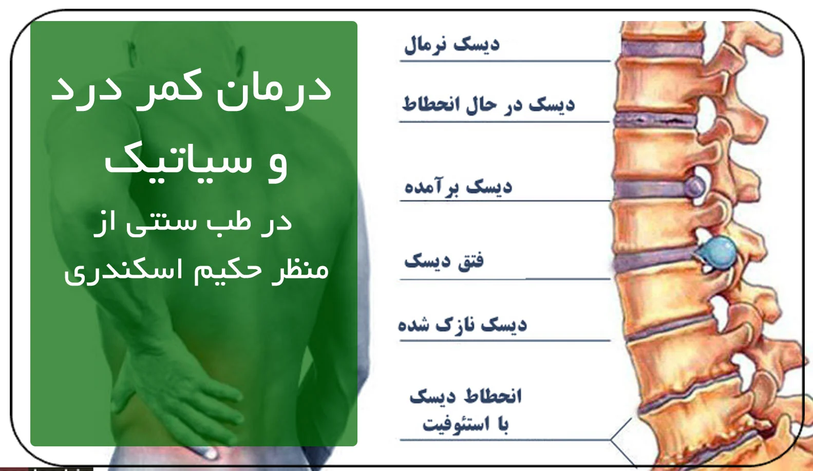 درمان