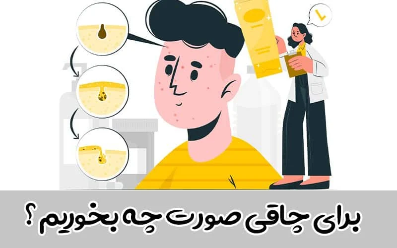 چاقی