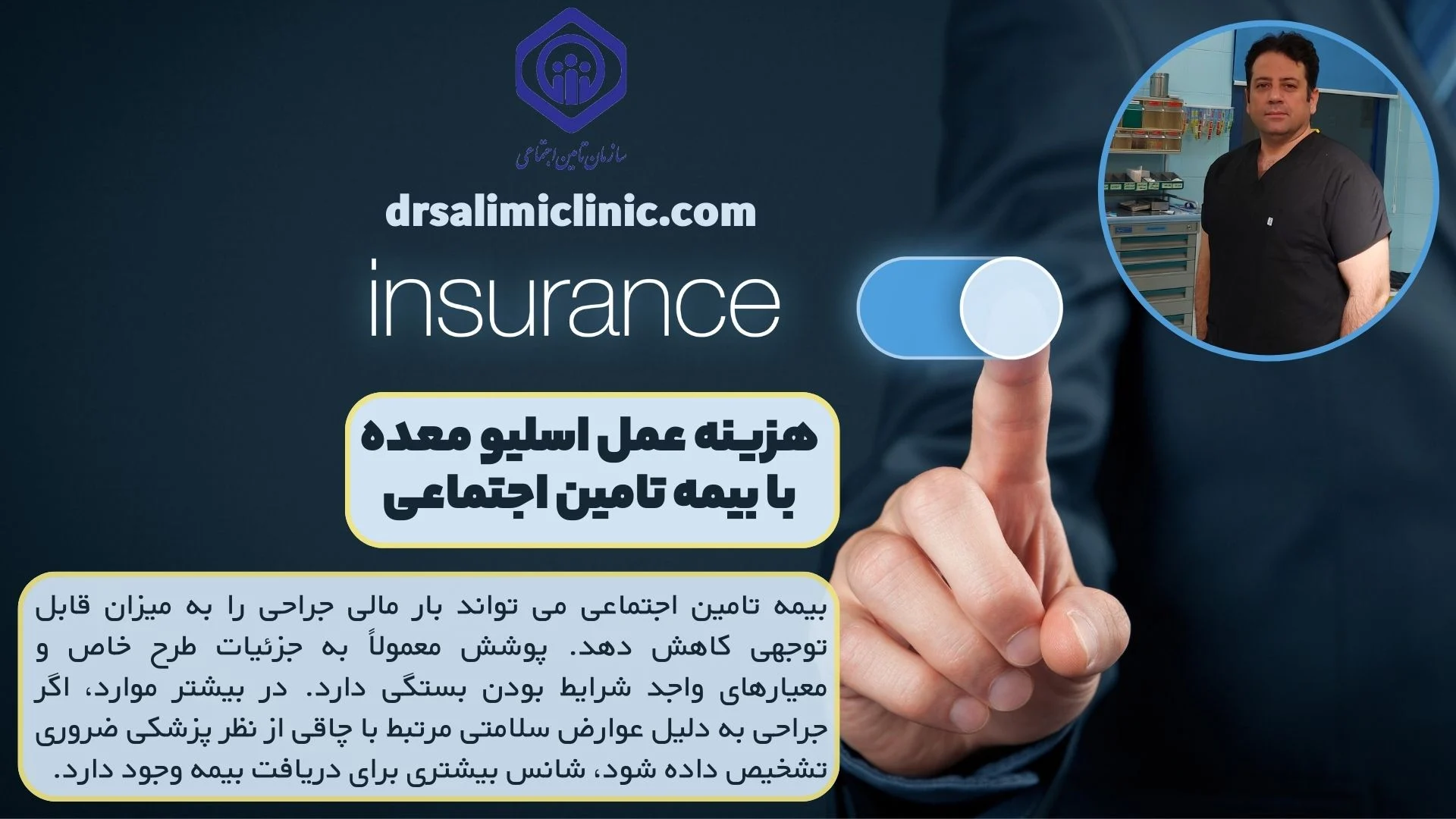 اسلیو معده | بیمه اسلیو معده